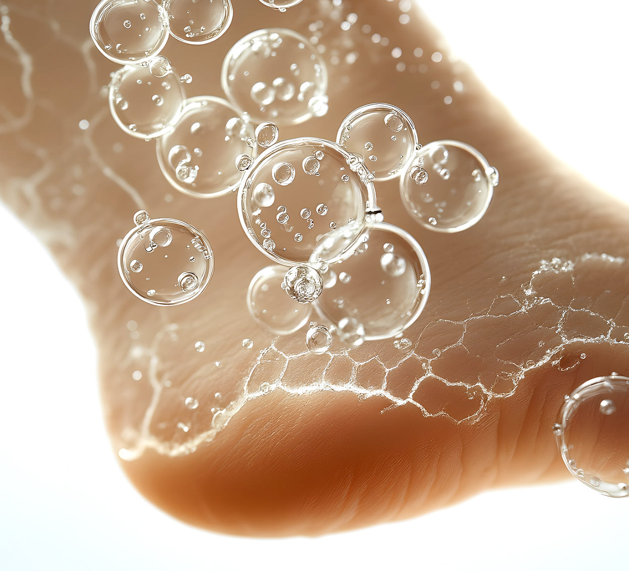 Hyperkeratosis: What It Is and How to Manage It