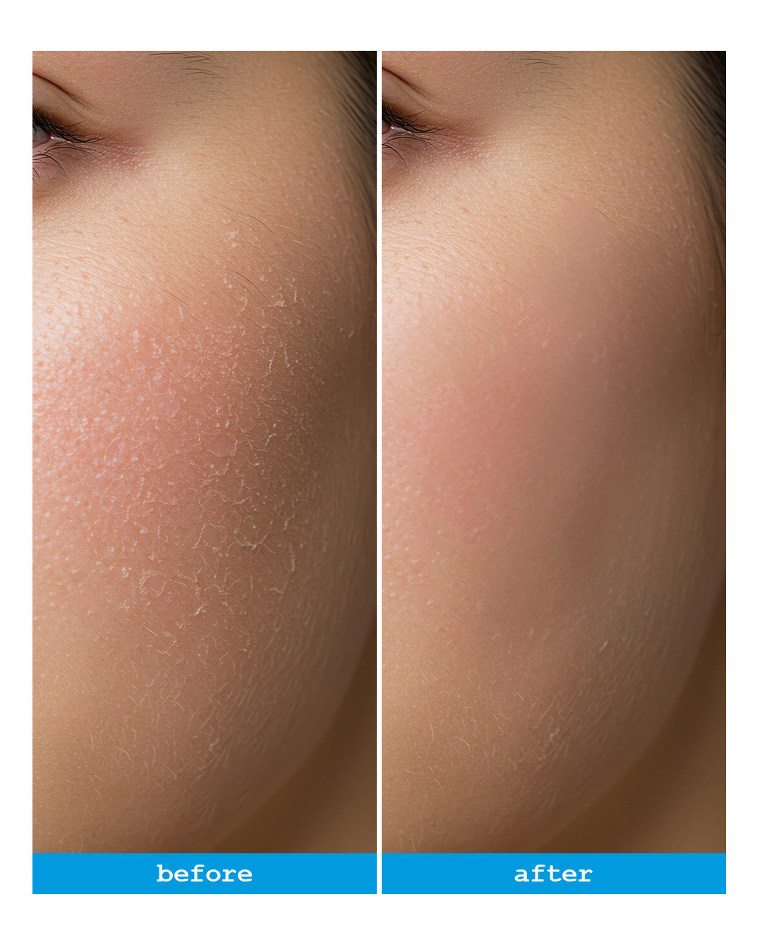 Senicil Advanced Daily Moisturising Cream