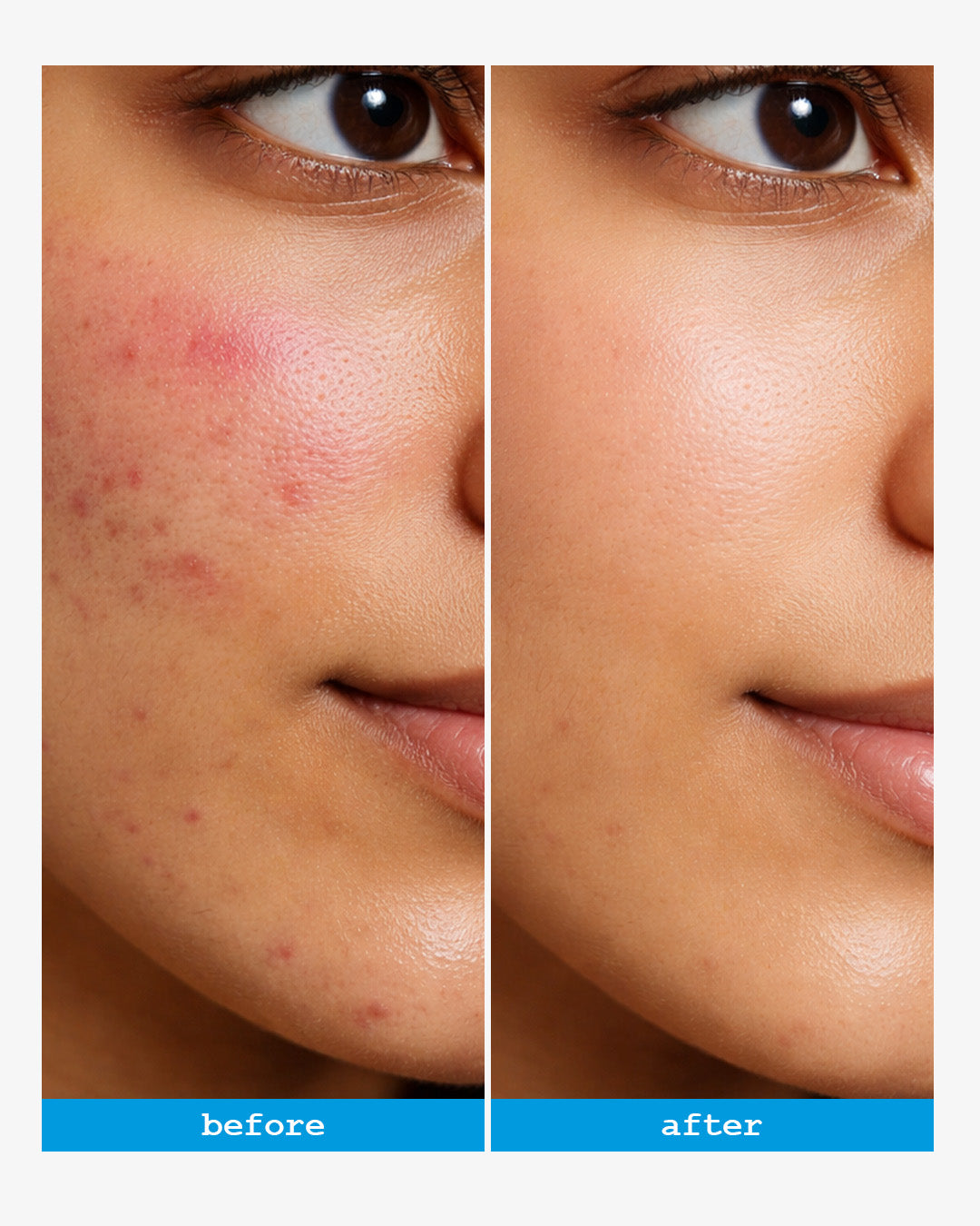 Senicil Advanced Gentle Cleanser