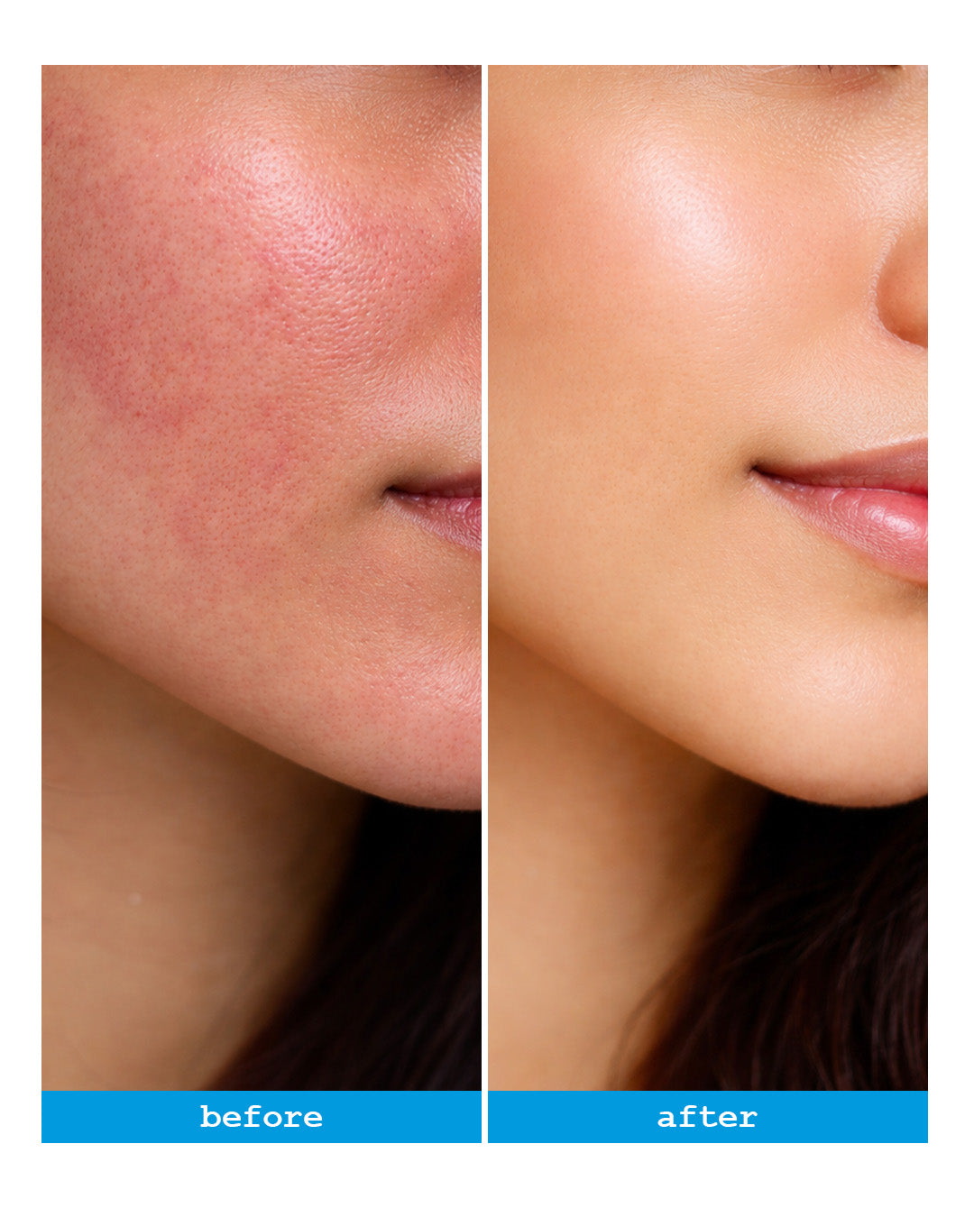 DERMACY 100% Mineral No-Chemical Sunscreen
