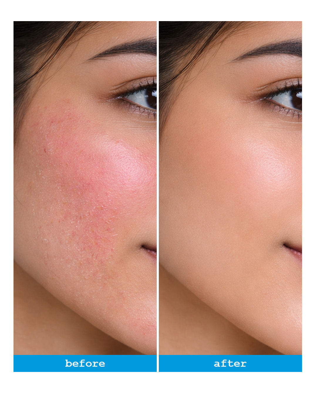 Senicil Advance Intensive Moisturising Cream